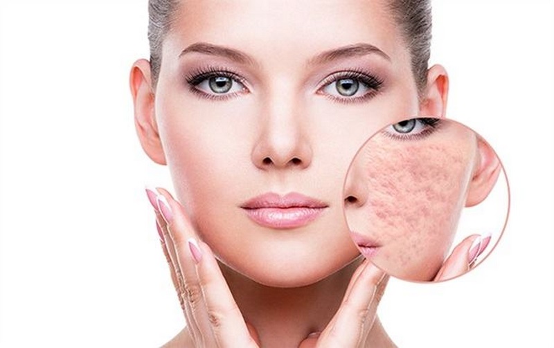 Quy trình cách chăm sóc da mặt bị rỗ tại nhà