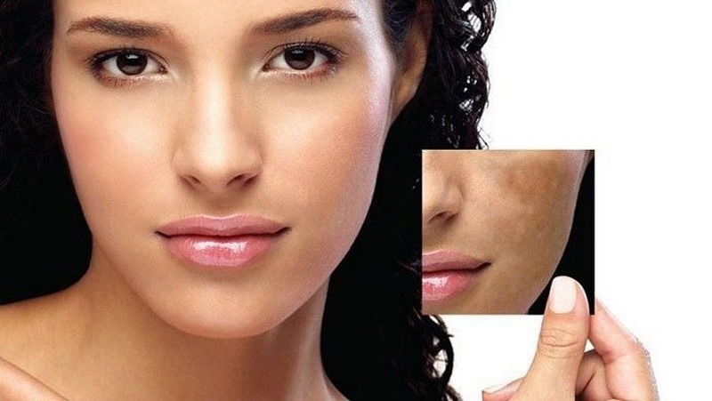 Cách cách chăm sóc da mặt không đều màu siêu tiết kiệm