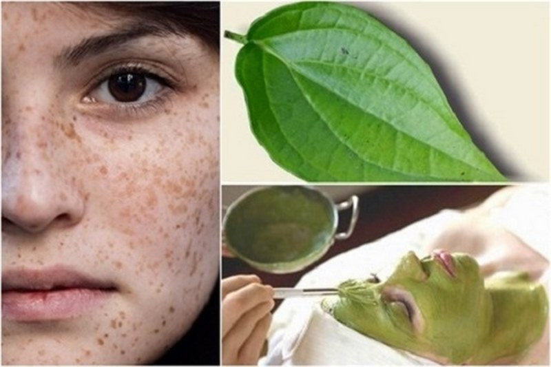 Cách chữa nám da mặt bằng lá trầu không có trị nám được không?