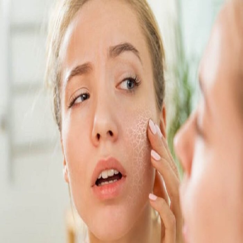10 bí quyết giúp nàng cách dưỡng da mặt vào mùa đông