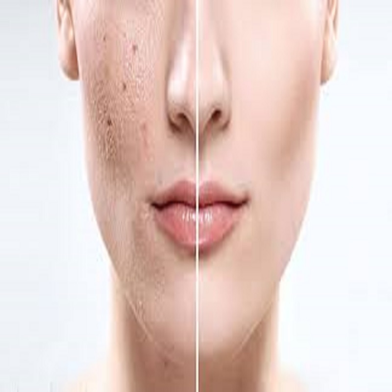 Nguyên nhân, cách phục hồi da mặt bị hư tổn tại nhà